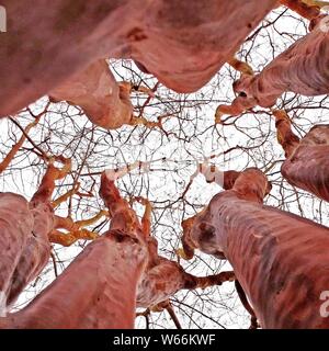 covid-19 vs allergie dans les symptômes respiratoires Banque D'Images