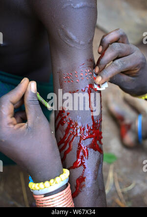 Le scarifiage avec une lame de rasoir, Suri, l'Éthiopie tribu Banque D'Images