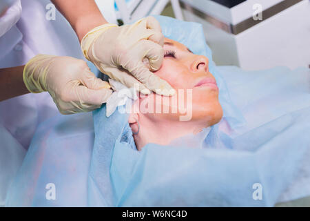 Faire mesothreads femme d'âge et de levage, la cosmétologie. Chirurgie esthétique pour éliminer les signes de vieillissement. Beauté Visage, contour du visage, plastique Banque D'Images