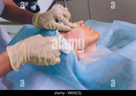 Faire mesothreads femme d'âge et de levage, la cosmétologie. Chirurgie esthétique pour éliminer les signes de vieillissement. Beauté Visage, contour du visage, plastique Banque D'Images