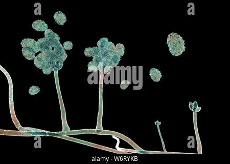 Le Stachybotrys sp. structure de fructification avec des spores, illustration de l'ordinateur. Souvent connu comme la moisissure toxique (moisissure noire). Plusieurs souches de ce champignon (S. atra, S. chartarum et S. alternans) sont synonymes. Ce champignon peut produire une mycotoxine trichothécène les satratoxines (H) qui est un toxique par inhalation. Les toxines sont présentes sur la spores fongiques. Les toxines produites par ce champignon va supprimer le système immunitaire affectant les tissus lymphoïdes et la moelle osseuse. Les spores vont mourir facilement après la libération mais les morts sont toujours des spores et allergènes. toxigpnes Banque D'Images