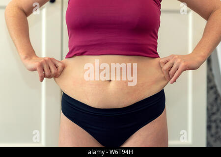 Chubby woman hand holding sa propre graisse du ventre à l'extérieur sous le soleil. Banque D'Images