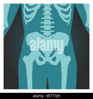 Émission de rayons X du bassin et de la colonne vertébrale, des os du corps humain, de radiographie, de l'illustration vectorielle. Illustration de Vecteur
