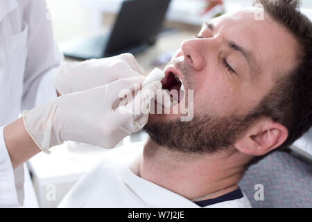 Visage d'un homme blanc avec une bouche ouverte sur un fauteuil dentaire. Les mains du médecin en gants blancs changer le rouleau de lignine dans la bouche du patient. Banque D'Images