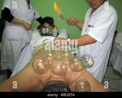 --FILE--un Chinois reçoit cupping therapy de la médecine traditionnelle chinoise (TCM) hôpital de Jilin, province de Jilin du nord-est de la Chine, 24 au Banque D'Images