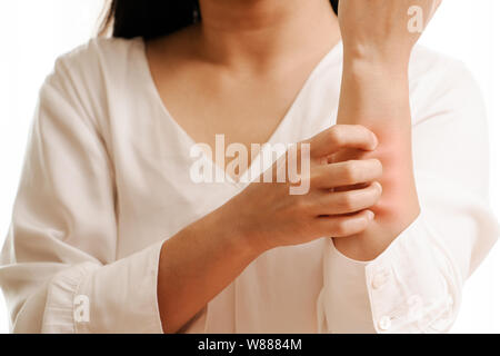 Les femmes part gratter les poils sur le bras, santé et médecine concept Banque D'Images
