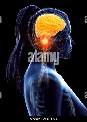 Le cancer du cerveau, l'ordinateur conceptuel illustration. Banque D'Images