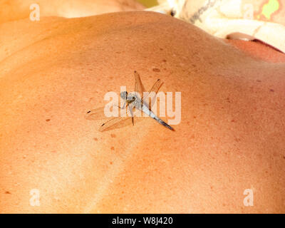Bleu libellule assis sur la peau humaine close up, teinté retour d'un homme avec un insecte Banque D'Images