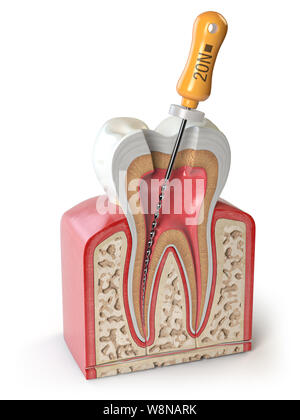 Section transversale de la dent avec fichier d'endodontie isolé sur blanc. 3d illustration Banque D'Images