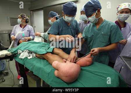 Les médecins de mesurer et de prendre des photos de la grands pieds du jeune garçon chinois Xiao hommes avant une chirurgie dans une salle d'opération à l'Hôpital pour enfants de Shang Banque D'Images