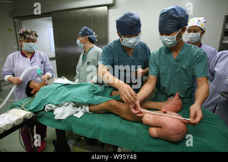 Les médecins de mesurer et de prendre des photos de la grands pieds du jeune garçon chinois Xiao hommes avant une chirurgie dans une salle d'opération à l'Hôpital pour enfants de Shang Banque D'Images