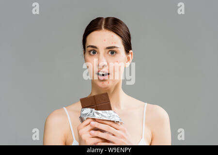 Surpris femme brune avec l'acné sur le visage maintenant barre de chocolat isolé sur gray Banque D'Images