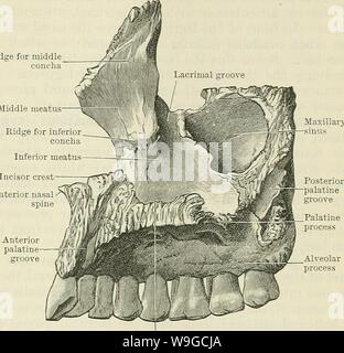 Image d'archive à partir de la page 180 de Cunningham's Text-book d'anatomie (1914). Cunningham's Text-book d'anatomie cunninghamstextb00cunn Année : 1914 MAXILLAEY ( L'OS. 147 ou postéro-latérale est séparée de la surface au-dessus du bord libre arrondi, qui forme la marge antérieure de la crête au milieu du méat moyen concha processus Frontal Épine nasale antérieure processus Palatin Fig. 158.-Le droit maxillaire (Aspect médial). L'infrastructure - l'aspect temporel des orbitales d'une qualité inférieure de la scissure orbitale dans le crâne articulé. Un teriorly Inferiorlyand- il n'est séparé de la surface antérieure par l'zygomati Banque D'Images