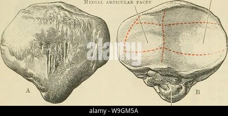 Image d'archive à partir de la page 279 de Cunningham's Text-book d'anatomie (1914). Cunningham's Text-book d'anatomie cunninghamstextb00cunn Année : 1914 ( 246 OSTÉOLOGIE. Facette articulaire latérale plan habituellement, ou quelque peu convexe transversalement. Parfois, dans la macération de l'os, les indices d'une troisième zone verticale sont à noter le long du bord médial de l'aspect postérieur. Ceci définit la partie de la surface articulaire qui repose sur la frontière latérale de la face interne en flexion extrême condyle. Dans l'état récemment, lorsque la fémorale sur- face est recouverte d'un cartilage, plus com- plexes arraDgement Banque D'Images