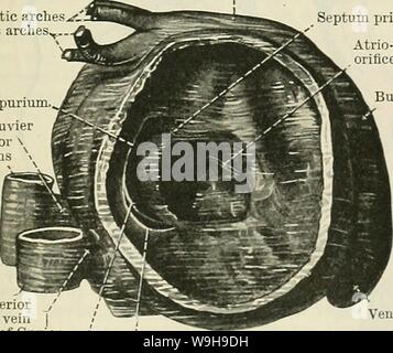 Image d'Archive de la page 1066 de Cunningham's Text-book d'anatomie (1914). Cunningham's Text-book d'anatomie cunninghamstextb00cunn Année : 1914 ( Fig. 829. Sillon interventriculaire -Section du Cœur de l'embryon humain. (L'Université d'Édimbourg collection.) 6ème arcs aortiques1. 4ème arcs aortiques, septum spurium conduit gauche antérieure gauche de Cuvier, septum primum veines cardinales de l'orifice atrio-ventriculaire cordis de la bulbe du canal artériel et la partie adjacente de la bulbe cordis ; et (2) l'atrium primitif est divisée en la droite et gauche de l'oreillette permanente par la forma- tion de deux intera Banque D'Images