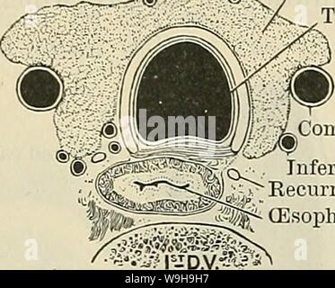 Image d'Archive de la page 1113 de Cunningham's Text-book d'anatomie (1914). Cunningham's Text-book d'anatomie cunninghamstextb00cunn Année : 1914 ( 1080 EESPIEATOEY LE SYSTÈME. Sa- Thyreoid fevjLCommon la trachée artère carotide corps ife- .J (oesophage artère thyreoid inférieure gauche du nerf récurrent commun ,'JF, carotide -'Jp&Lt ; stimulation du nerf artère subclavière gauche artère innommé CORPS YREOID [- nerf vague nerf vague plèvre L. artère subclavière gauche nerf récurrent et fascia cervical conduit thoracique tégument, séparer la partie cervicale de la trachée de la surface. Dans le pla Banque D'Images