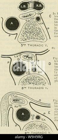 Image d'Archive de la page 1184 de Cunningham's Text-book d'anatomie (1914). Cunningham's Text-book d'anatomie cunninghamstextb00cunn Année : 1914 ( Fig. B, à la 3e thoracic verte- bra, indique le canal thoracique couché sur le côté gauche de l'ocde- phagus. 3r.d V. thoracique à la Fig. C, au niveau de la 5ème thoracic verte- bra, la bronche gauche est considérée par rapport à tbeauteriorsur- visage de l'oesophage. Fig. D est au niveau de la 8e verte thoracique- bra, et montre le péricarde allongé sur la surface antérieure de l'ocde- phagus.  Ig.E,enle- bra 19thoracic verte, montre l'oesophage en- c Banque D'Images