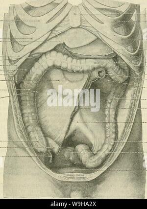 Image d'Archive de la page 1242 de Cunningham's Text-book d'anatomie (1914). Cunningham's Text-book d'anatomie cunninghamstextb00cunn Année : 1914 ( petit intestin. 1209 à l'autre, s'appliquent à une très courte distance de la paroi abdominale postérieure, il sera ici être trouvés pour former une ligne ondulée ou ondulées. Plus loin encore cette condition devient de plus en plus marquée ; et enfin, si l'intestin est retiré en coupant à travers le mésentère près de son attache- ment à la paroi intestinale, on voit que son bord libre n'est pas seulement ondulé, mais est en stretch ou tressées à un degré extrême. Banque D'Images