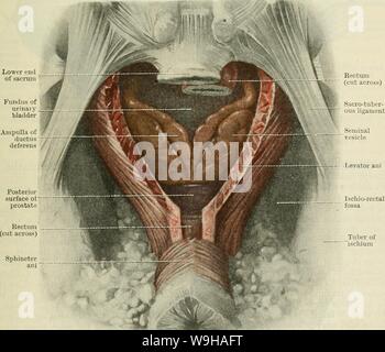 Image d'Archive de la page 1326 de Cunningham's Text-book d'anatomie (1914). Cunningham's Text-book d'anatomie cunninghamstextb00cunn Année : 1914 ( Rectum l'extrémité inférieure du sacrum Fundus de vessie canal déférent ampoule de sphincter anal levator ani symphyse ischio-rectale de fossa de tubercule ischion Fig. 1012.-Dissection d'afficher l'aspect postérieur de la Vesicul.e Seminales, le Amitll.e du canal Deferentes, et de la prostate. Le coccyx et des parties de l'ani levatores ont été supprimées, également une partie considérable du rectum. certains cas les vésicules séminales sont beaucoup plus petits que d'habitude, un Banque D'Images