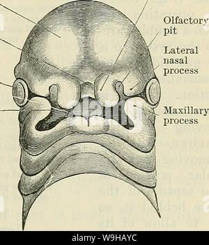 Image d'Archive de la page 1412 de Cunningham's Text-book d'anatomie (1914). Cunningham's Text-book d'anatomie cunninghamstextb00cunn Année : 1914 ( LE VISAGE. 1379 (2) grâce à la canine fossa, latéral à la proéminence provoquée par la racine de la dent canine ; ou (3) à travers la paroi latérale de l'orifice du nez. Dans un skiagram antéro-postérieur du crâne, l'ombre de la sinus maxillaire présente un schéma pyramidal, la base correspondant à l'étage de l'orbite et le sommet arrondi à l'évidement de l'alvéolaire sinus. Parfois, le plancher du sinus s'étend au-dessous de la ligne médiane, th Banque D'Images