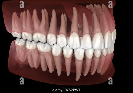 De la morphologie des maxillaires et mandibulaires et des dents gencives. Dent précise médicalement 3D illustration Banque D'Images