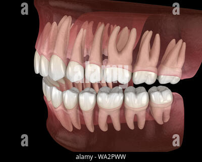 De la morphologie des maxillaires et mandibulaires et des dents gencives. Dent précise médicalement 3D illustration Banque D'Images