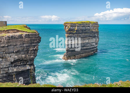 Pile la mer, Downpatrick Head, comté de Mayo, Irlande Banque D'Images