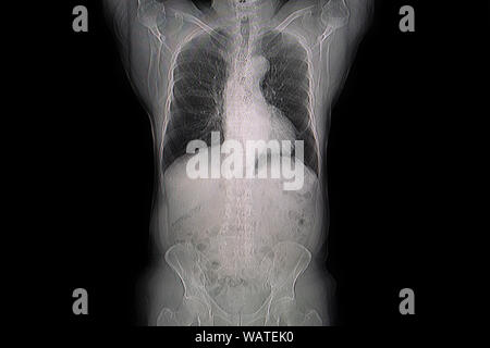 Définir la radiographie film pris d'examiner le coeur. Concept de la santé. Banque D'Images