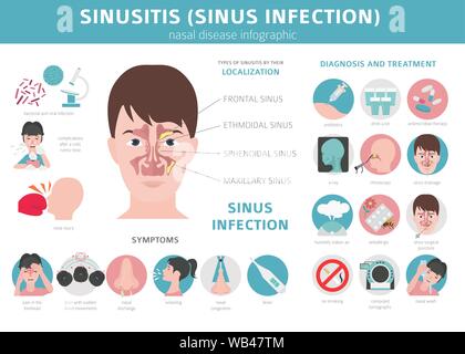Maladies du nez. La sinusite, infection des sinus Diagnostic et traitement medical infographic design. Vector illustration Illustration de Vecteur