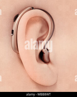 L'aide auditive générique autour de l'oreille. 3D illustration. Banque D'Images