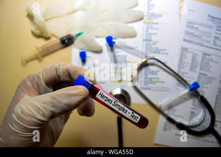 - Test de l'Herpès simplex avec échantillon de sang. Vue de dessus de bureau isolé sur 24. Concept de soins santé/médecine Banque D'Images