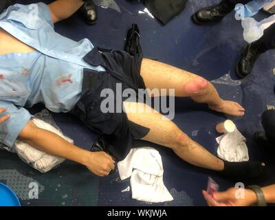 Beijing, Chine. 12Th Mar, 2019. Photo prise le 11 août 2019 blessé montre un agent de police de Hong Kong dans le sud de la Chine à Hong Kong. Source : Xinhua/Alamy Live News Banque D'Images