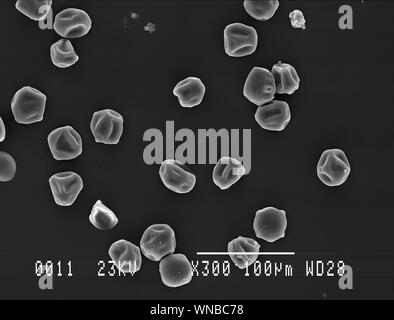 Beaucoup de charme les grains de pollen de l'analyse des électrons Microphotographie Banque D'Images