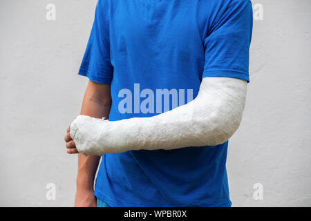 Homme avec bras cassé enveloppé medical cast plâtre. Plâtre en fibre de verre couvrant le poignet, le bras, le coude après un accident de sport, isolated on white Banque D'Images