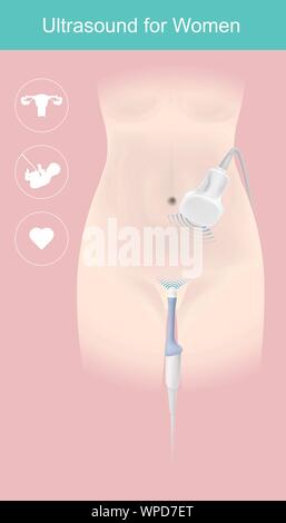 Exemples illustrent l'utilisation d'instruments médicaux en ministère de l'obstétricien pour femmes l'examen ou la grossesse, en montrant à l'écran de l'ordinateur Illustration de Vecteur