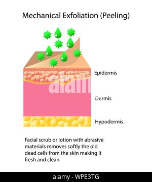 L'exfoliation mécanique ou peeling, vector illustration sur fond clair Illustration de Vecteur