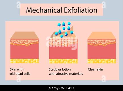 L'exfoliation mécanique ou peeling, vector illustration sur fond clair Illustration de Vecteur