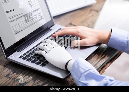 Homme avec prothèse de main travaillant sur ordinateur portable. Membre artificiel Banque D'Images
