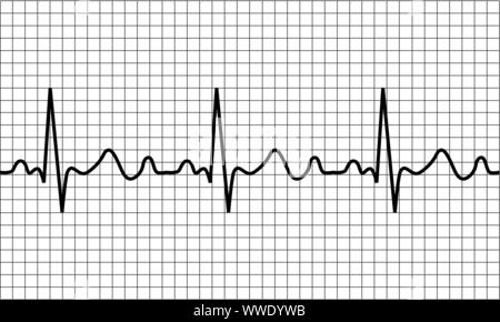 L'icône de pulsation. Pathologie ECG Trace, Vector illustration Illustration de Vecteur