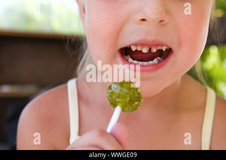 Enfant mange des bonbons. Fille a sur les dents des caries. Banque D'Images