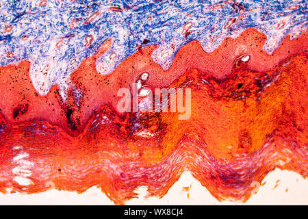 Cicatrice peau tissus sous le microscope 100x Banque D'Images