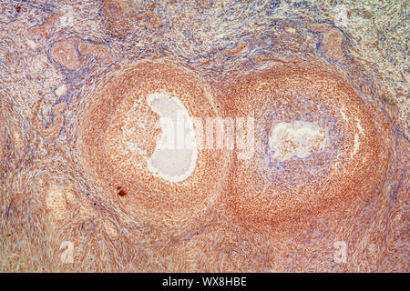 Les tissus de l'ovaire sous le microscope 100x Banque D'Images
