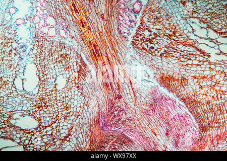 La carotte à l'échelle 100x Banque D'Images