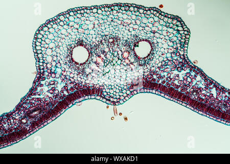 Poison ivy leaf cross section 100x Banque D'Images