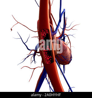 Arteria, arteria mostrato con una sezione tagliata, di alta qualità di rendering originale con texture e illuminazione globale, la contrazione dei vasi sanguigni Foto Stock