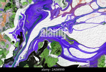 Scarsamente differenziato adenocarcinoma intestinale, micrografia di luce, foto al microscopio Foto Stock