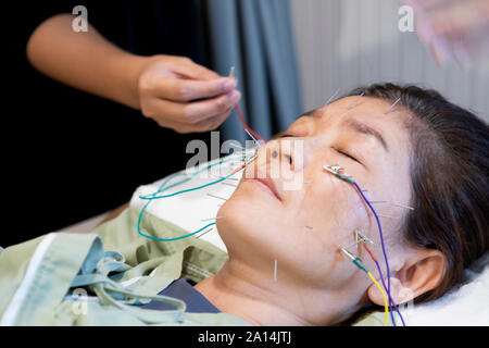 Donna asiatica subendo di agopuntura bellezza viso trattamento mediante ago elettrico la terapia Foto Stock