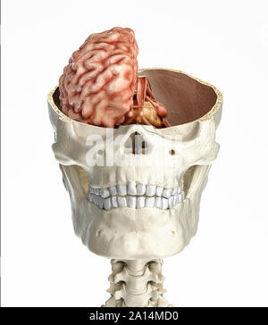 Cranio umano in sezione trasversale con il cervello. Foto Stock