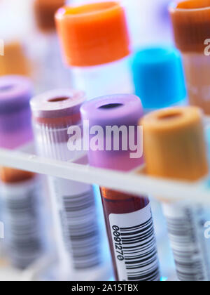 Una fila di campioni di sangue umano in attesa di test in laboratorio Foto Stock