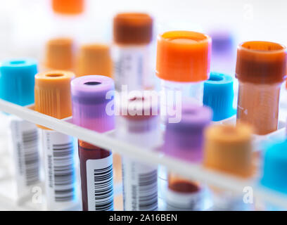 Una fila di campioni di sangue umano in attesa di test in laboratorio Foto Stock